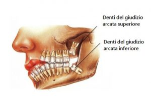 denti del giudizio