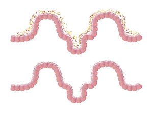 Microbiota intestinale: il secondo cervello del nostro corpo